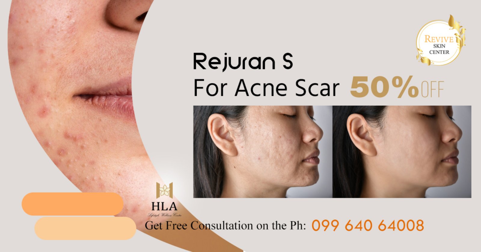 HLA Feb 2025_13